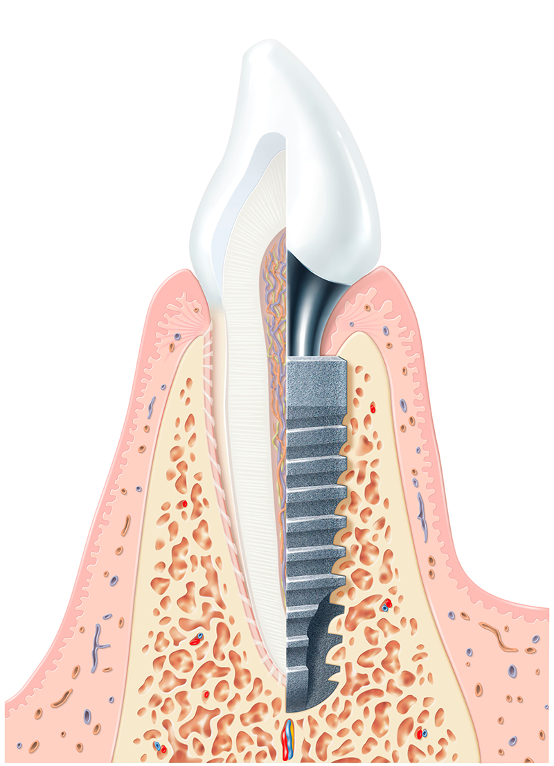 Zahn­implantate Copyright Camlog